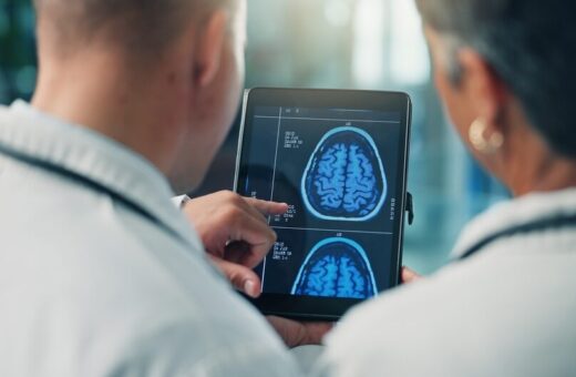 Fibrillazione atriale e declino cognitivo
